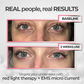 RevitalEyes